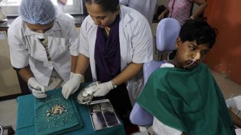 إزالة 232 سنا من فم صبي هندي خلال عملية جراحية دامت 7 ساعات (فيديو)