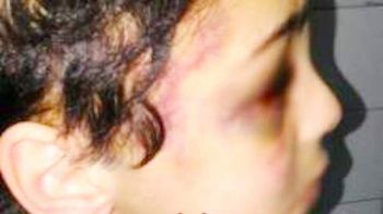 وقفة إحتجاجية بمكناس لمناصرة الطفل أيمن الذي تعرض للتعذيب من قبل أمه بالتبني
