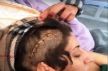 السلطات تغلق ملهيين ليليين في الراشدية بعد الإعتداء على راقصة وتشويه جسدها