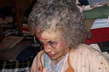جريمة بشعة: أم بمكناس تتعرض لمختلف أنواع التعذيب من ابنها البكر (صور)