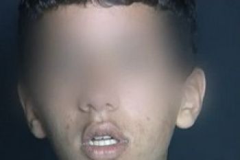 خيرية مكناس تطرد 30 نزيلا بعد فضحهم تحرشات جنسية داخل المؤسسة