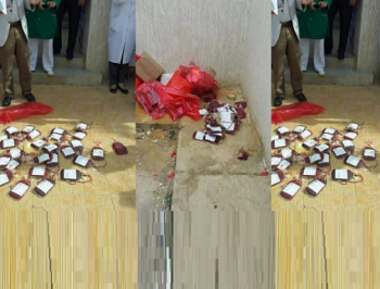 وزارة الصحة تؤكد أن صور أكياس الدم الملقاة على الأرض عند مدخل مركز تحاقن الدم بمكناس تعود لسنة 2014 