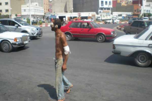 مستشفى الأمراض النفسية والعقلية بمكناس يلفظ مرضاه