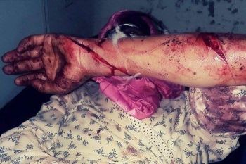 سائق هوندا بمكناس 'يشرمل' سيدة بعدما سجلت شكاية ضده