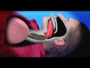 كيفية إنقاذ شخص بلع لسانه - أنشرها لتعم الفائدة